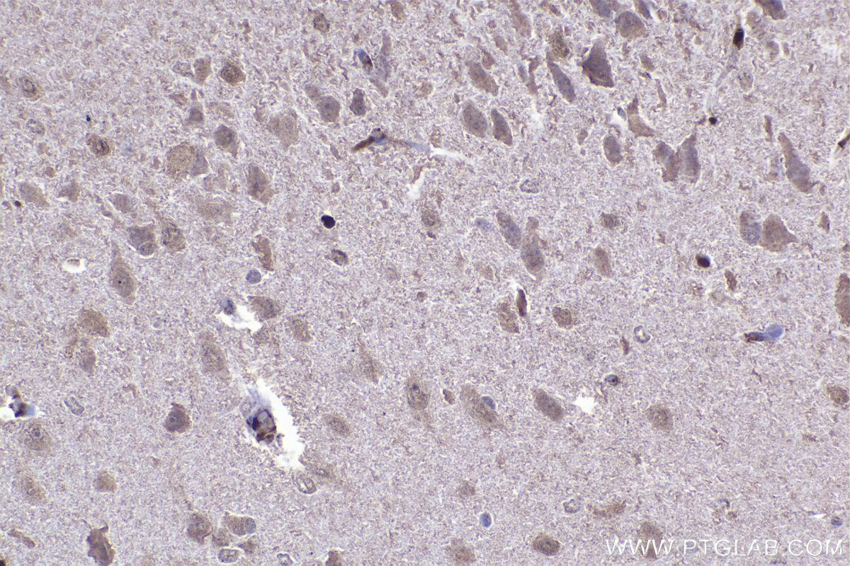 Immunohistochemistry (IHC) staining of rat brain tissue using DNAJA1 Monoclonal antibody (67184-1-Ig)