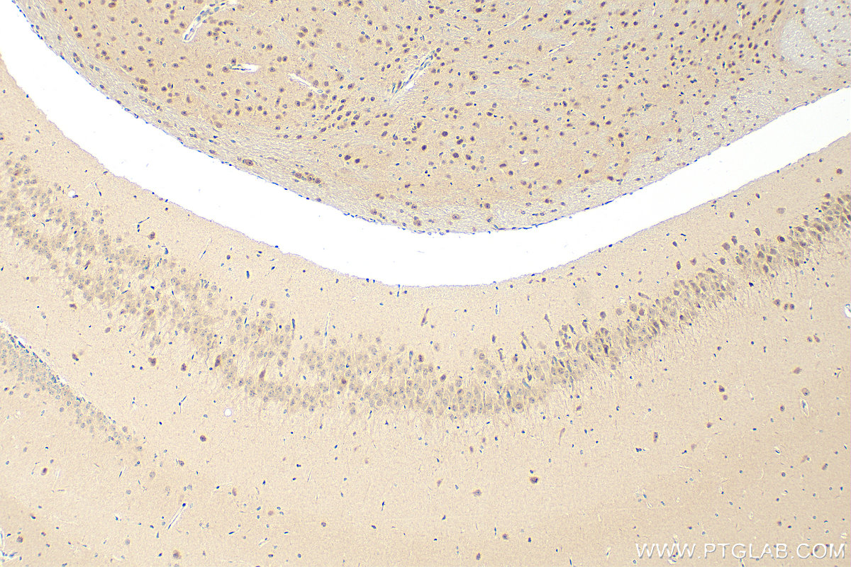 Immunohistochemistry (IHC) staining of mouse brain tissue using DNAJB1 Polyclonal antibody (13174-1-AP)