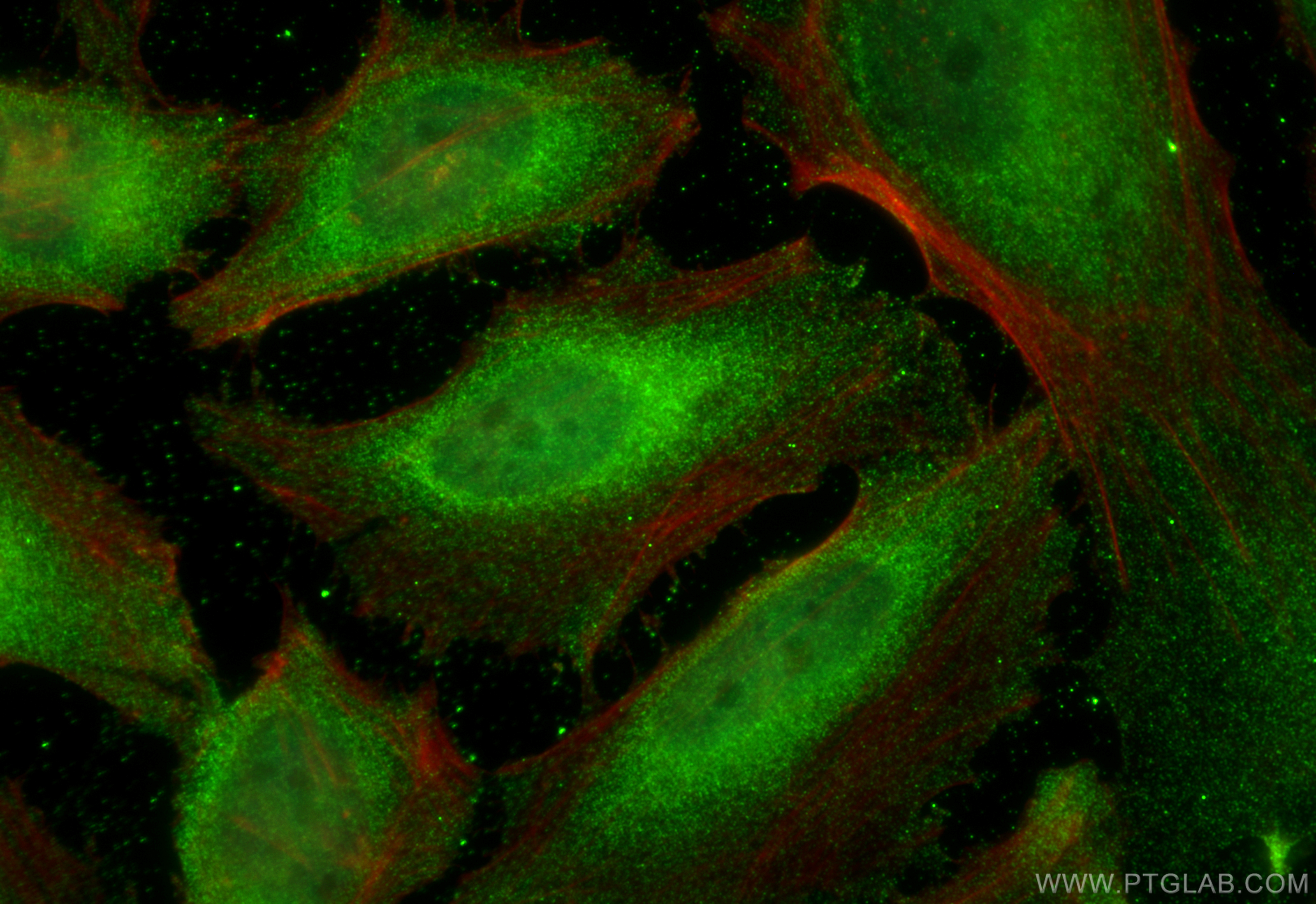 Immunofluorescence (IF) / fluorescent staining of HeLa cells using DNAJB1 Monoclonal antibody (67422-1-Ig)