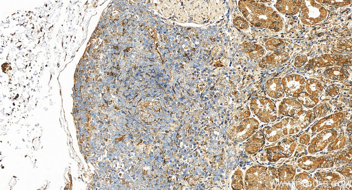 Immunohistochemistry (IHC) staining of human stomach tissue using DNAJB12 Polyclonal antibody (16780-1-AP)