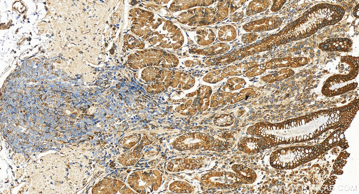 Immunohistochemistry (IHC) staining of human stomach tissue using DNAJB12 Polyclonal antibody (16780-1-AP)