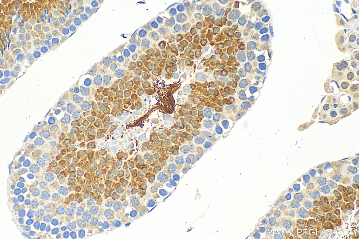 Immunohistochemistry (IHC) staining of mouse testis tissue using DNAJB13 Polyclonal antibody (25118-1-AP)