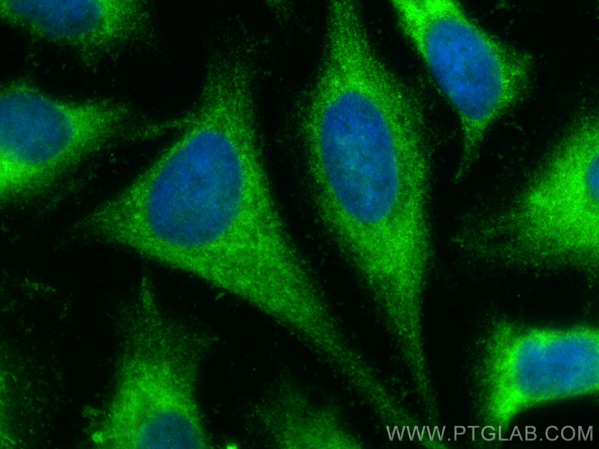 Immunofluorescence (IF) / fluorescent staining of HeLa cells using DNAJB14 Polyclonal antibody (16501-1-AP)