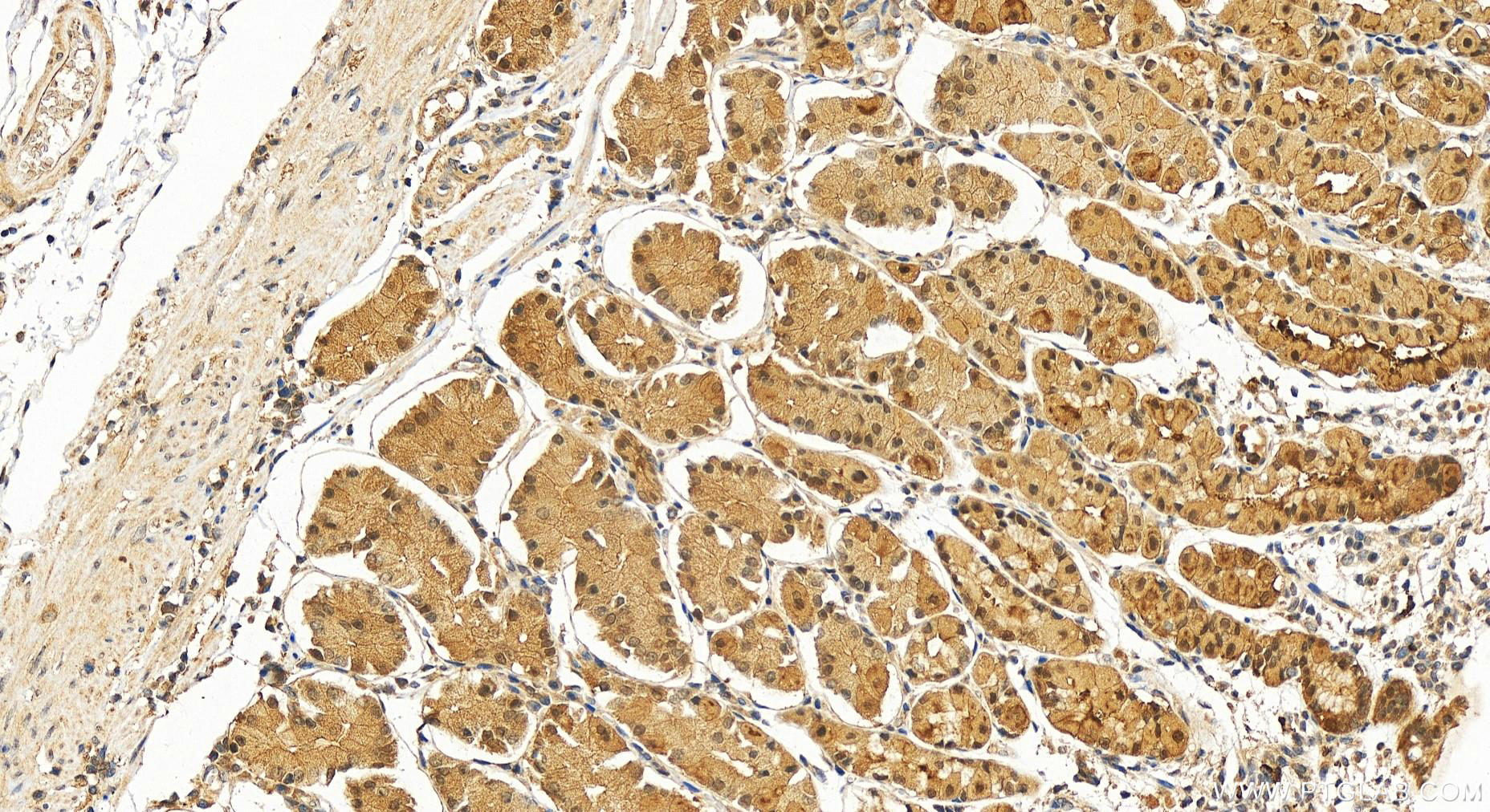 Immunohistochemistry (IHC) staining of human stomach tissue using DNAJB2 Polyclonal antibody (10838-1-AP)