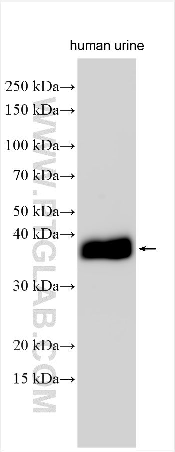 DNase I