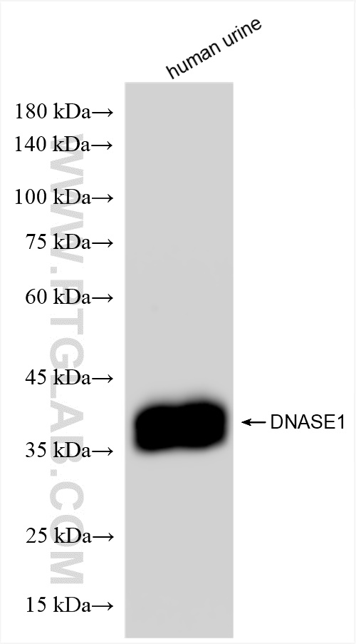 Western Blot (WB) analysis of human urine sample using DNase I Recombinant antibody (83337-6-RR)