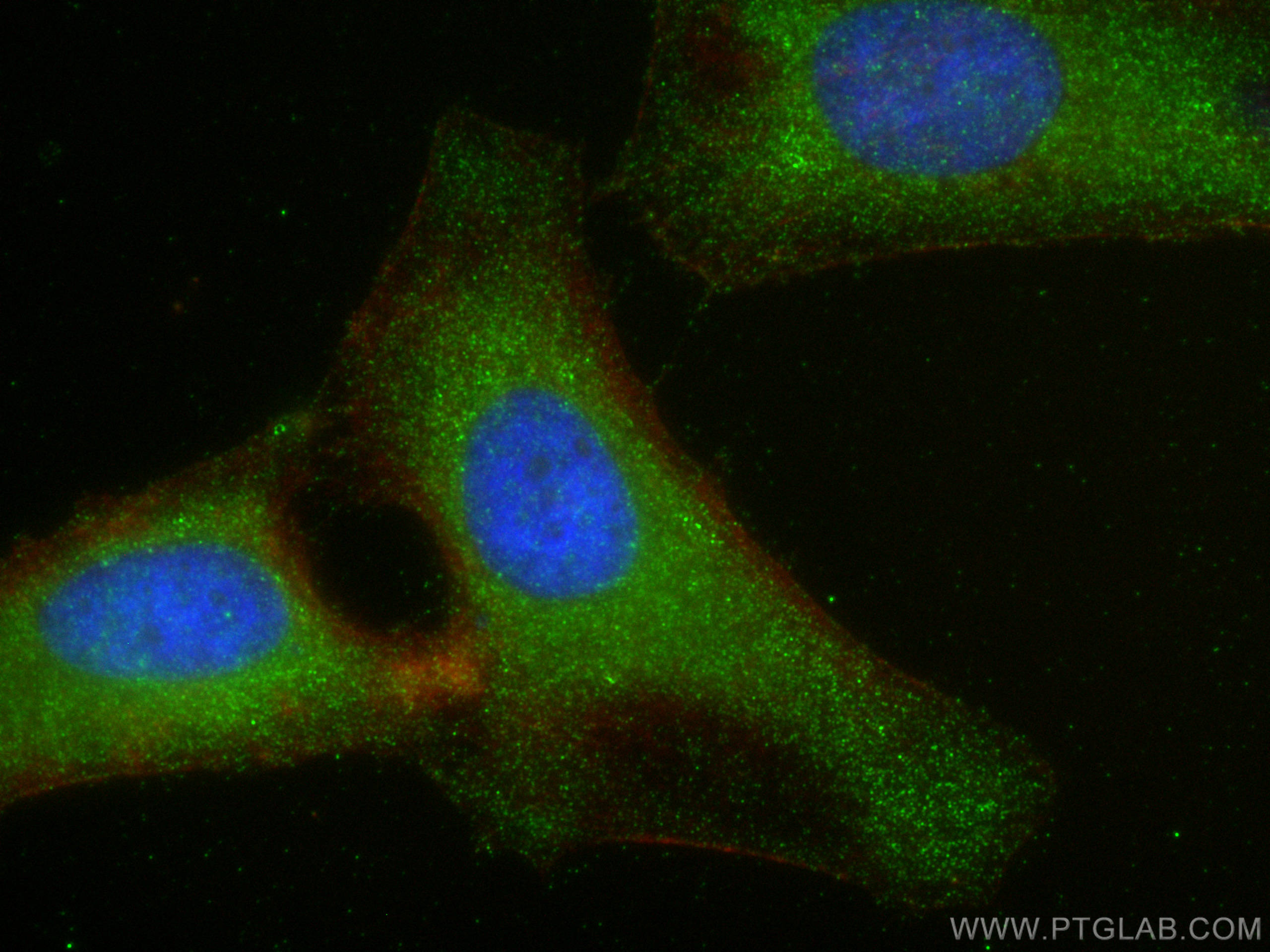 Immunofluorescence (IF) / fluorescent staining of HeLa cells using DNASE2 Polyclonal antibody (15934-1-AP)