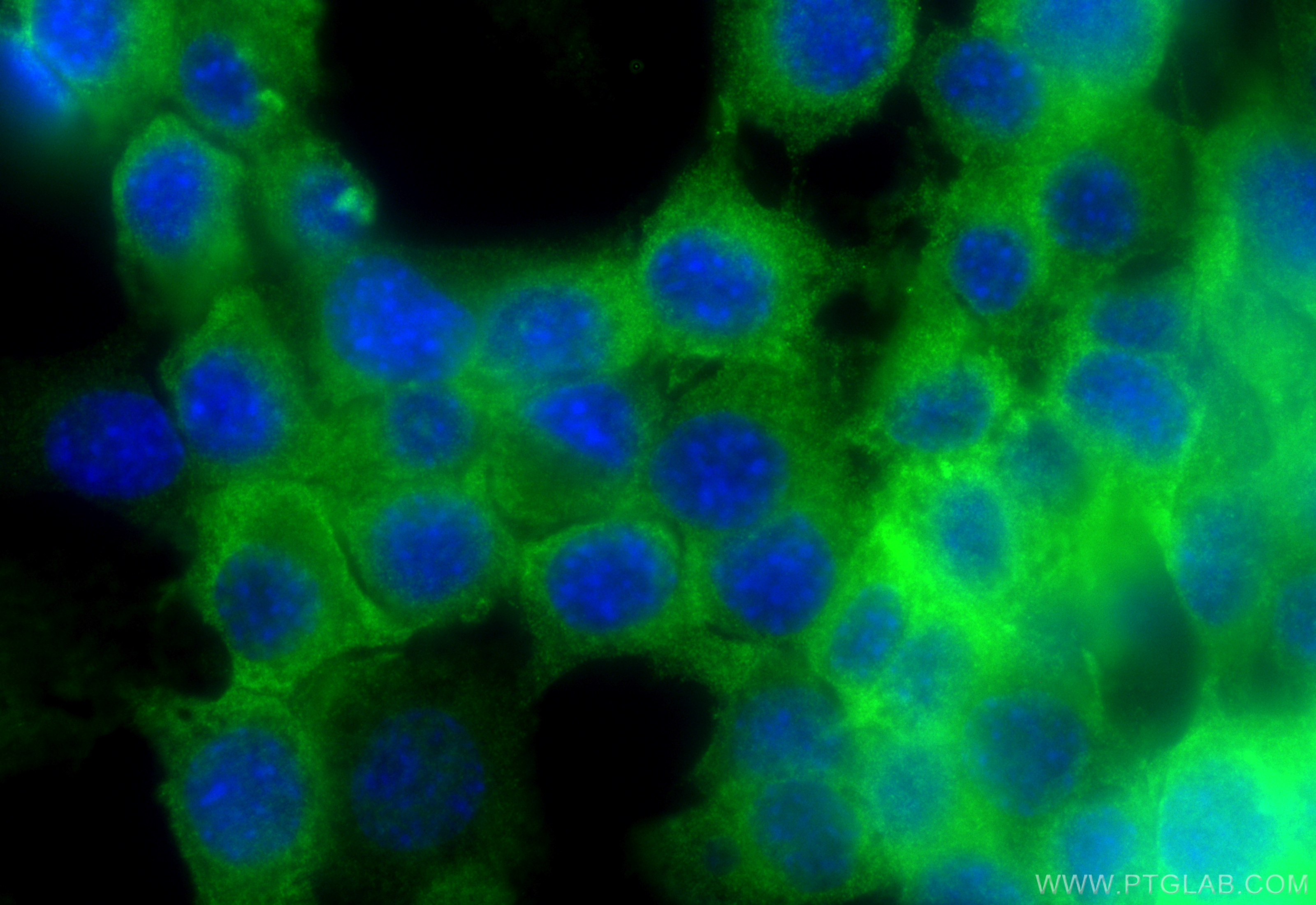 Immunofluorescence (IF) / fluorescent staining of Neuro-2a cells using DNM1 Monoclonal antibody (68009-1-Ig)