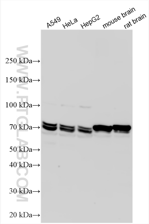 Western Blot (WB) analysis of various lysates using DRP1 (C-terminal) Polyclonal antibody (12957-1-AP)