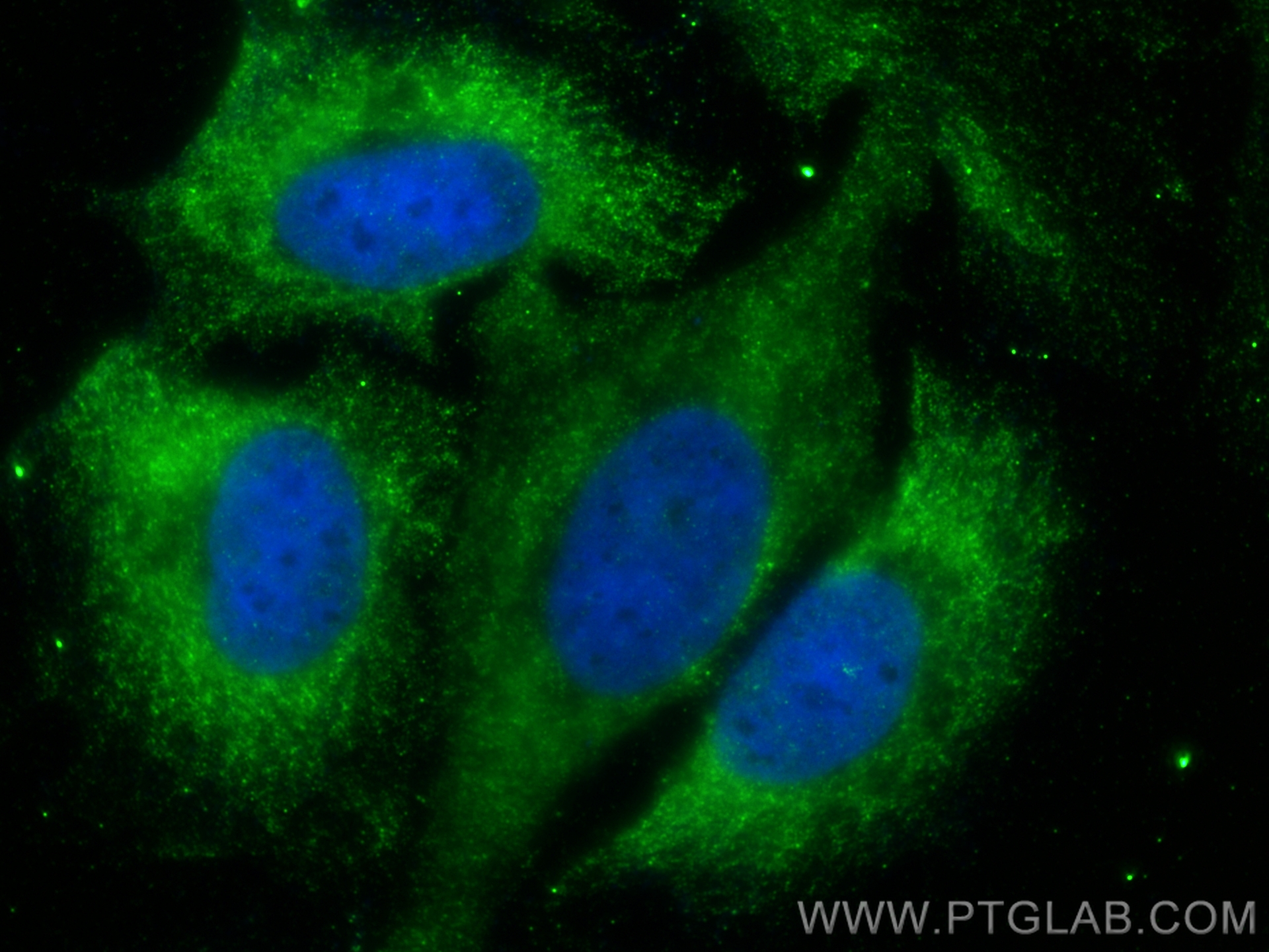 Immunofluorescence (IF) / fluorescent staining of HeLa cells using DRP1 (N-terminal) Polyclonal antibody (26187-1-AP)