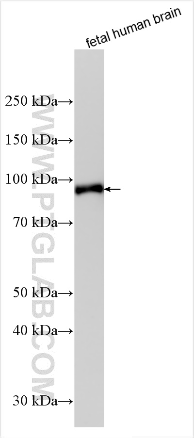 Western Blot (WB) analysis of various lysates using DNM3 Polyclonal antibody (14737-1-AP)