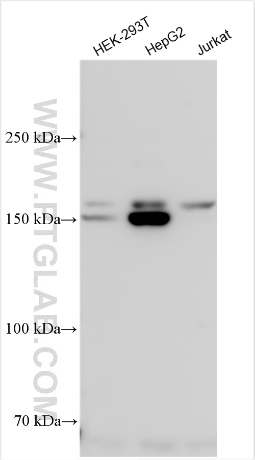 Western Blot (WB) analysis of various lysates using DNMT1 Polyclonal antibody (28754-1-AP)
