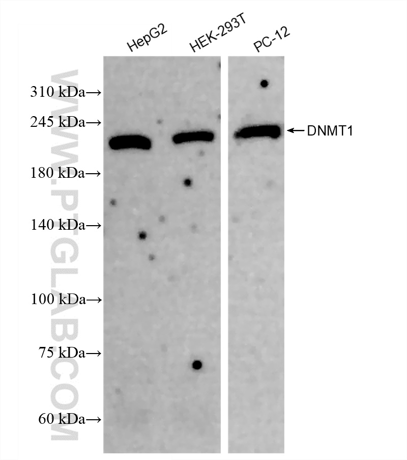 Western Blot (WB) analysis of various lysates using DNMT1 Recombinant antibody (82678-2-RR)
