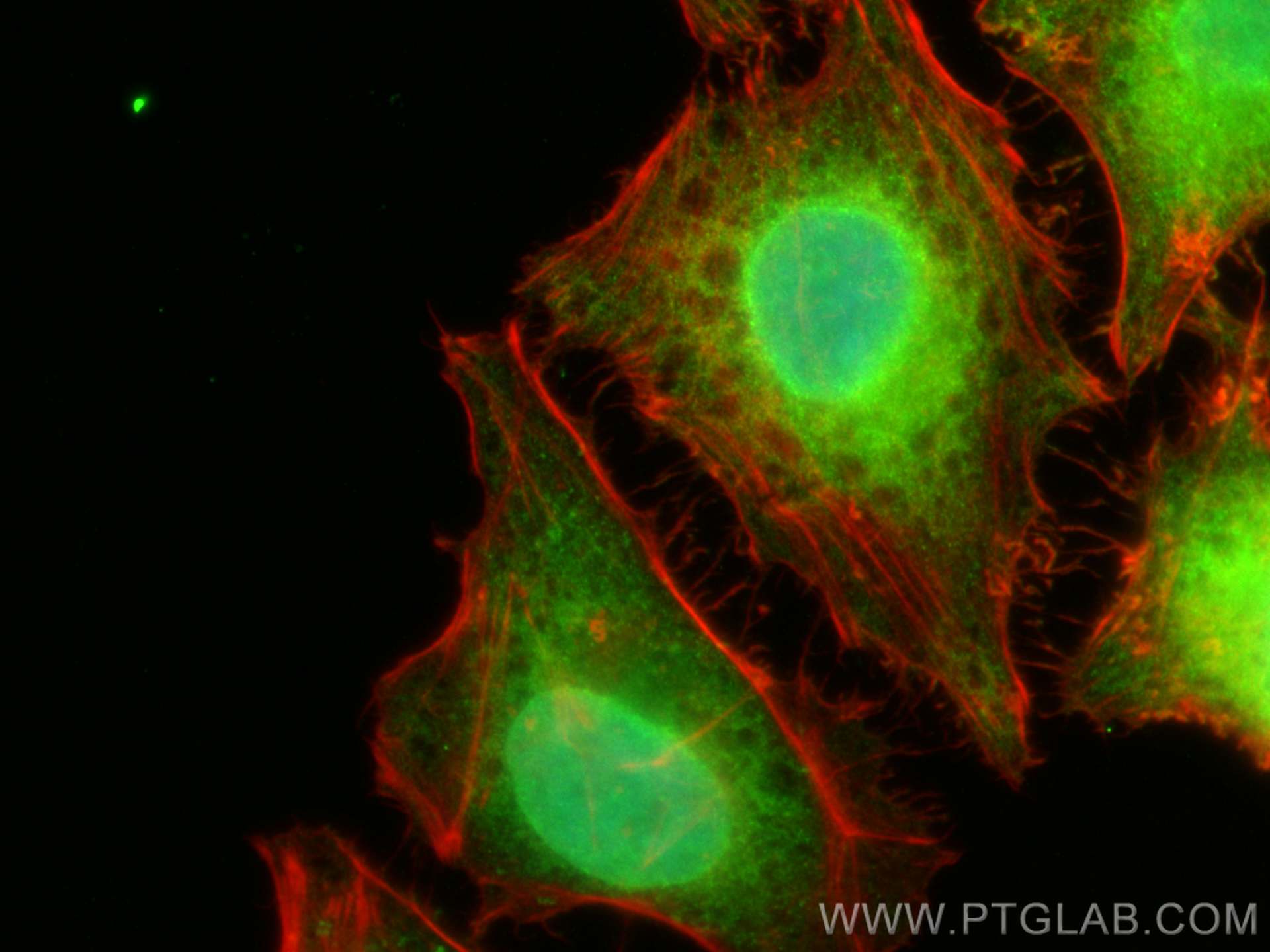 Immunofluorescence (IF) / fluorescent staining of HeLa cells using DNMT3A Polyclonal antibody (20954-1-AP)