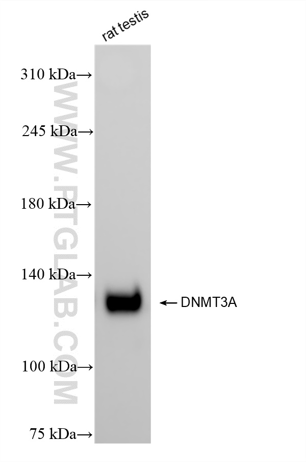 Western Blot (WB) analysis of rat testis tissue using DNMT3A Recombinant antibody (81474-5-RR)