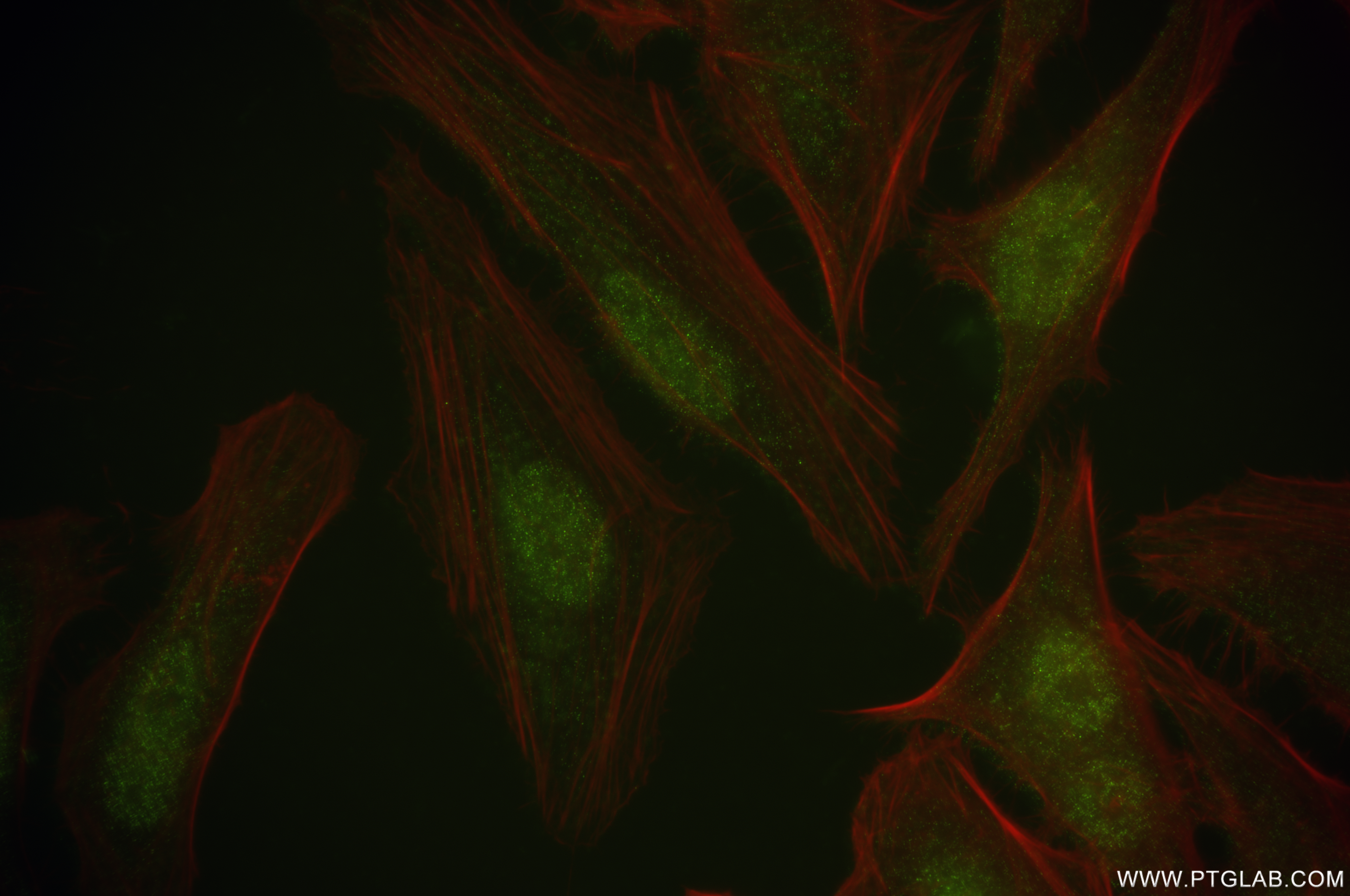 Immunofluorescence (IF) / fluorescent staining of HeLa cells using DNMT3A Recombinant antibody (81474-6-RR)