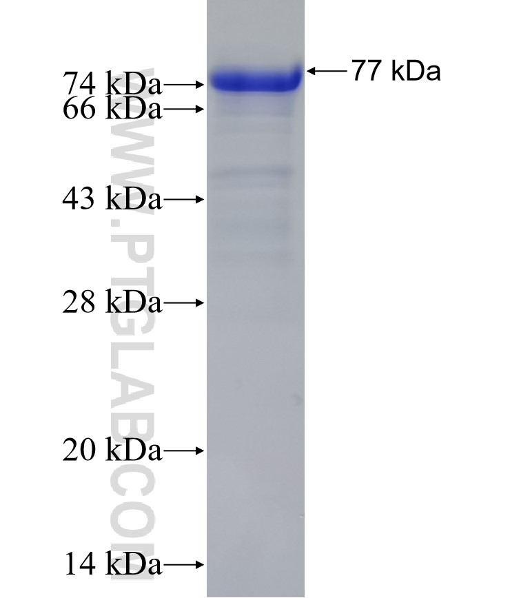 DNMT3A fusion protein Ag15111 SDS-PAGE