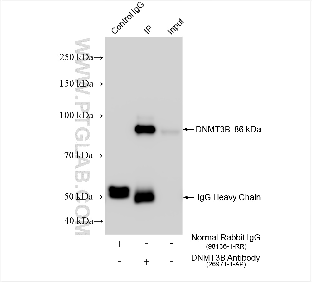 Immunoprecipitation (IP) experiment of K-562 cells using DNMT3B Polyclonal antibody (26971-1-AP)