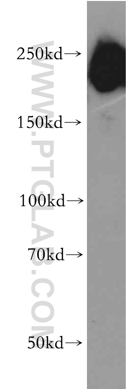 Western Blot (WB) analysis of human brain tissue using DOCK3; MOCA Polyclonal antibody (20683-1-AP)