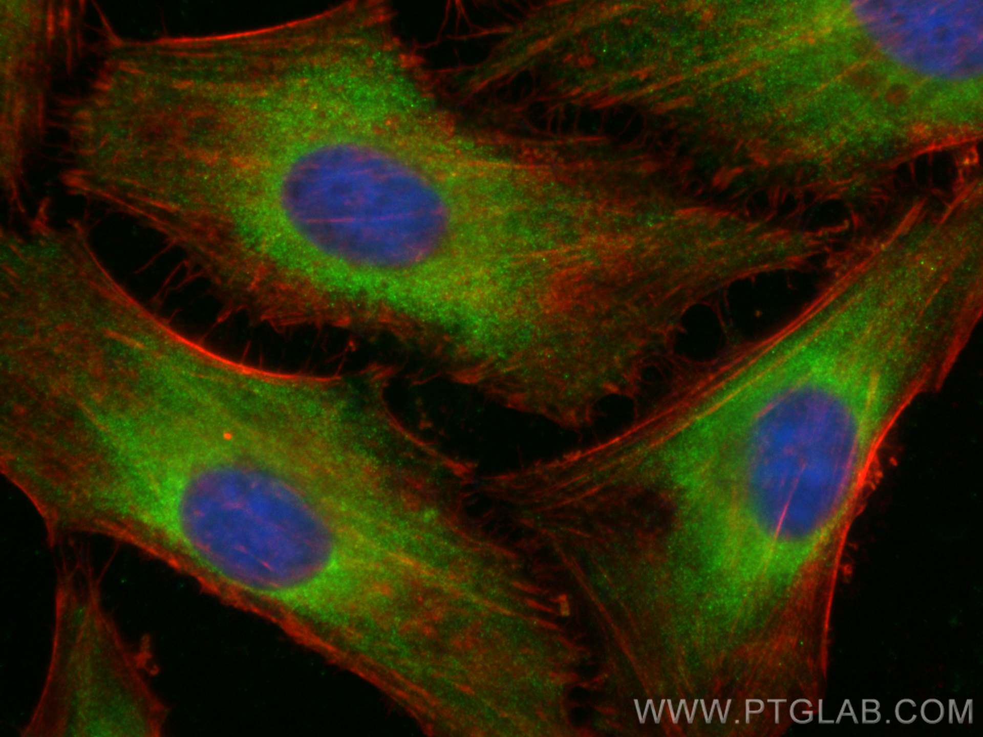 Immunofluorescence (IF) / fluorescent staining of HeLa cells using CoraLite® Plus 488-conjugated DOCK4 Polyclonal ant (CL488-27151)