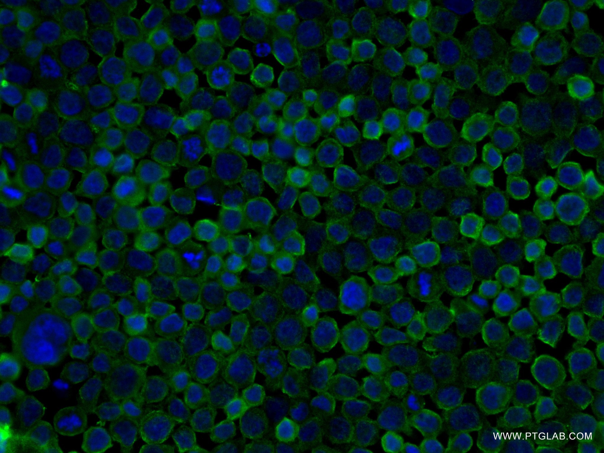 Immunofluorescence (IF) / fluorescent staining of THP-1 cells using DOCK8 Recombinant antibody (83270-2-RR)