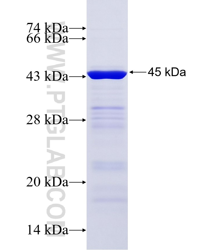 DOCK8 fusion protein Ag34585 SDS-PAGE