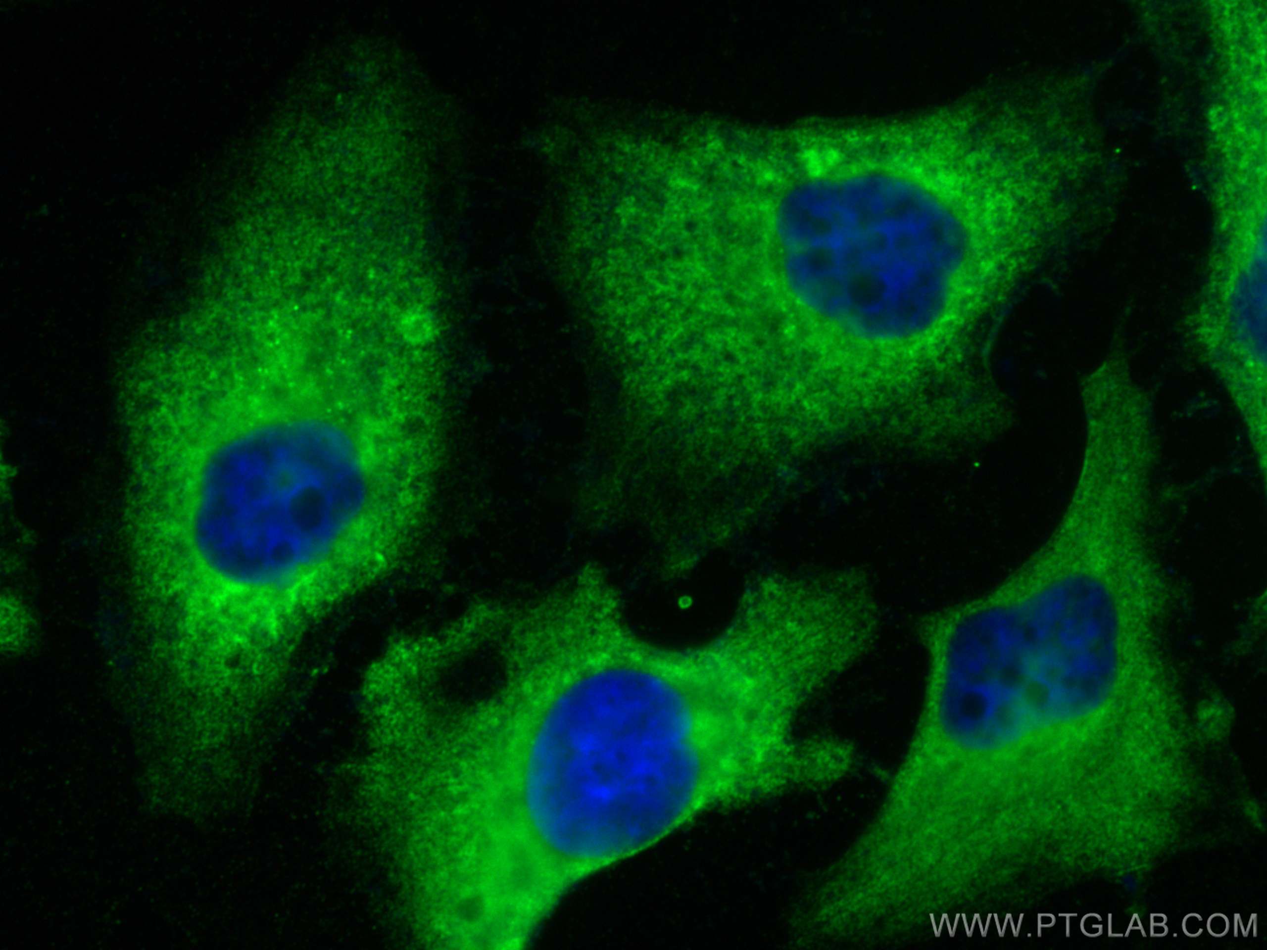 Immunofluorescence (IF) / fluorescent staining of HeLa cells using DOCK9 Polyclonal antibody (18987-1-AP)