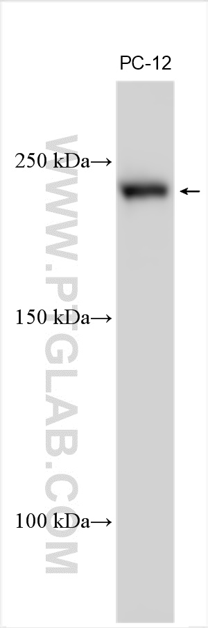 Western Blot (WB) analysis of various lysates using DOT1L Polyclonal antibody (28145-1-AP)