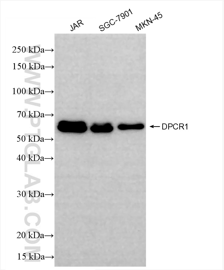 Western Blot (WB) analysis of various lysates using DPCR1 Recombinant antibody (84567-2-RR)