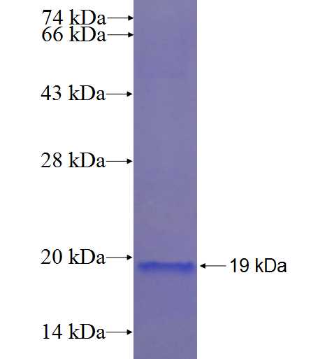 DPH3 fusion protein Ag22383 SDS-PAGE