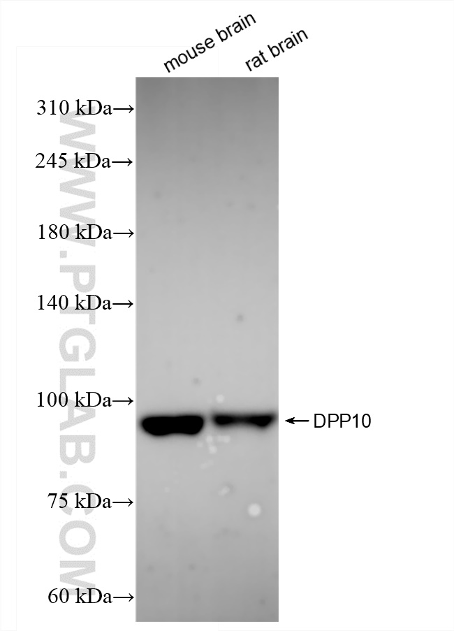 Western Blot (WB) analysis of various lysates using DPP10 Recombinant antibody (84127-2-RR)