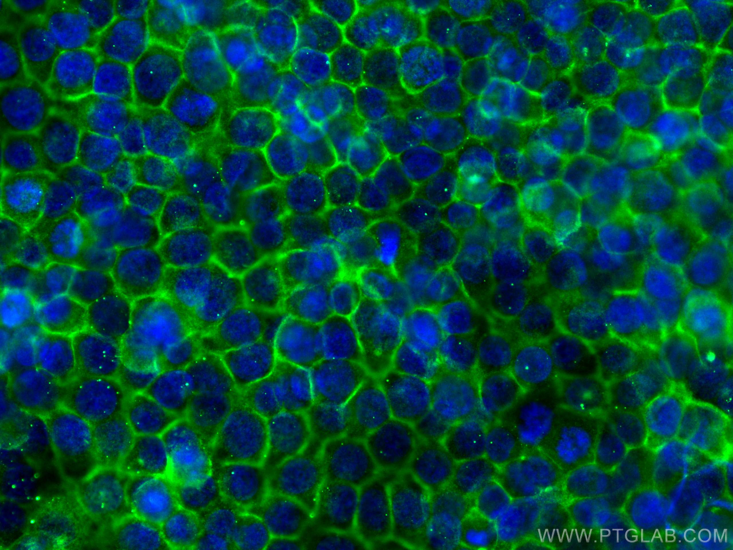 Immunofluorescence (IF) / fluorescent staining of HuH-7 cells using DPP4/CD26 Monoclonal antibody (68383-1-Ig)