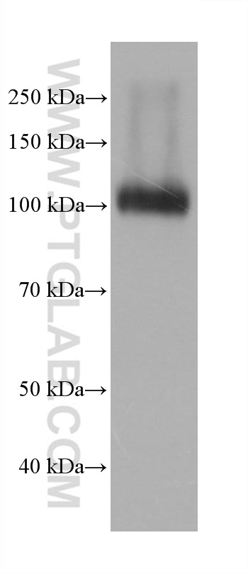 Western Blot (WB) analysis of HuH-7 cells using DPP4/CD26 Monoclonal antibody (68383-1-Ig)