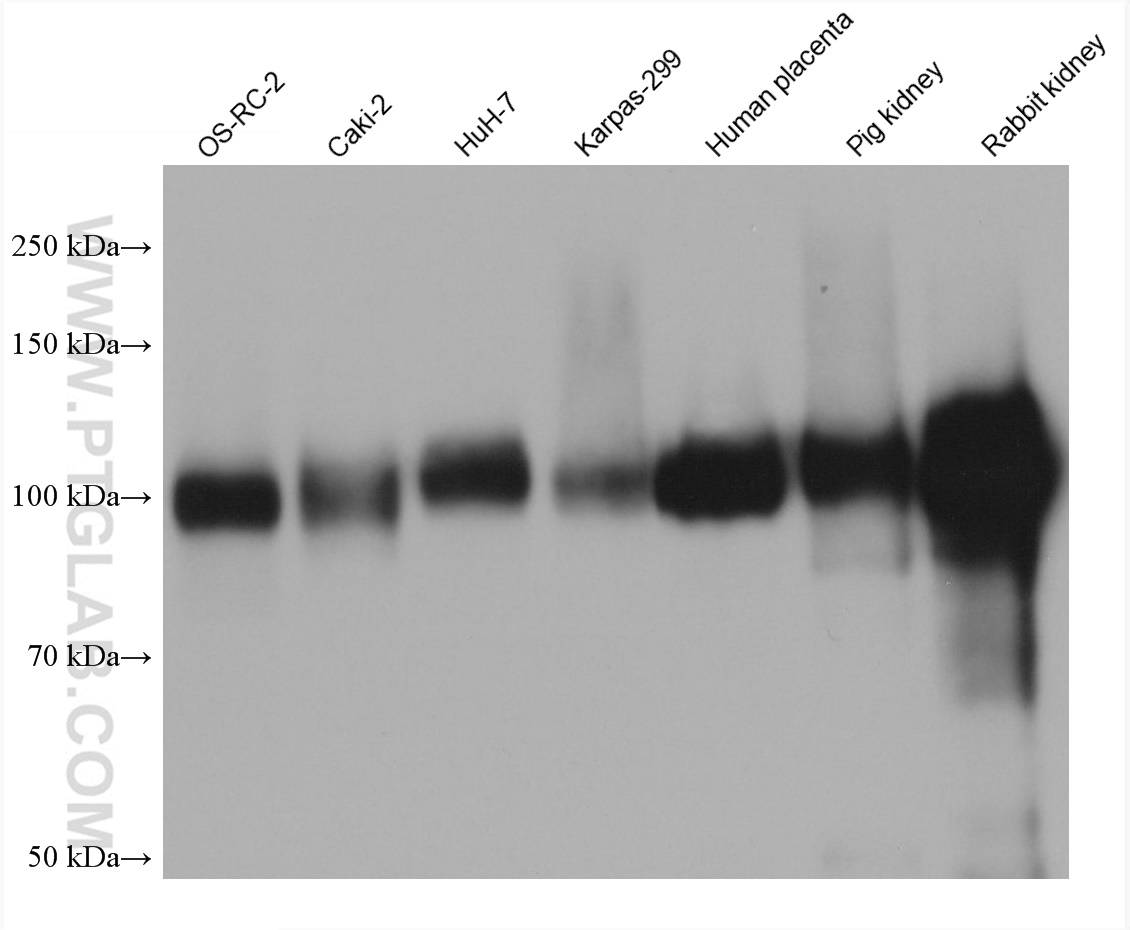 Western Blot (WB) analysis of various lysates using DPP4/CD26 Monoclonal antibody (68383-1-Ig)