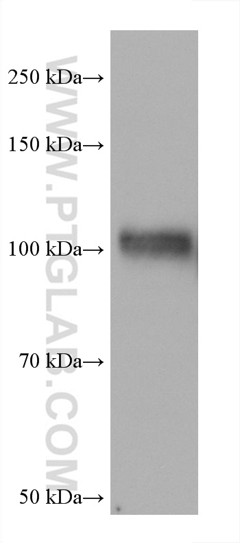 Western Blot (WB) analysis of HUVEC cells using DPP4/CD26 Monoclonal antibody (68383-1-Ig)