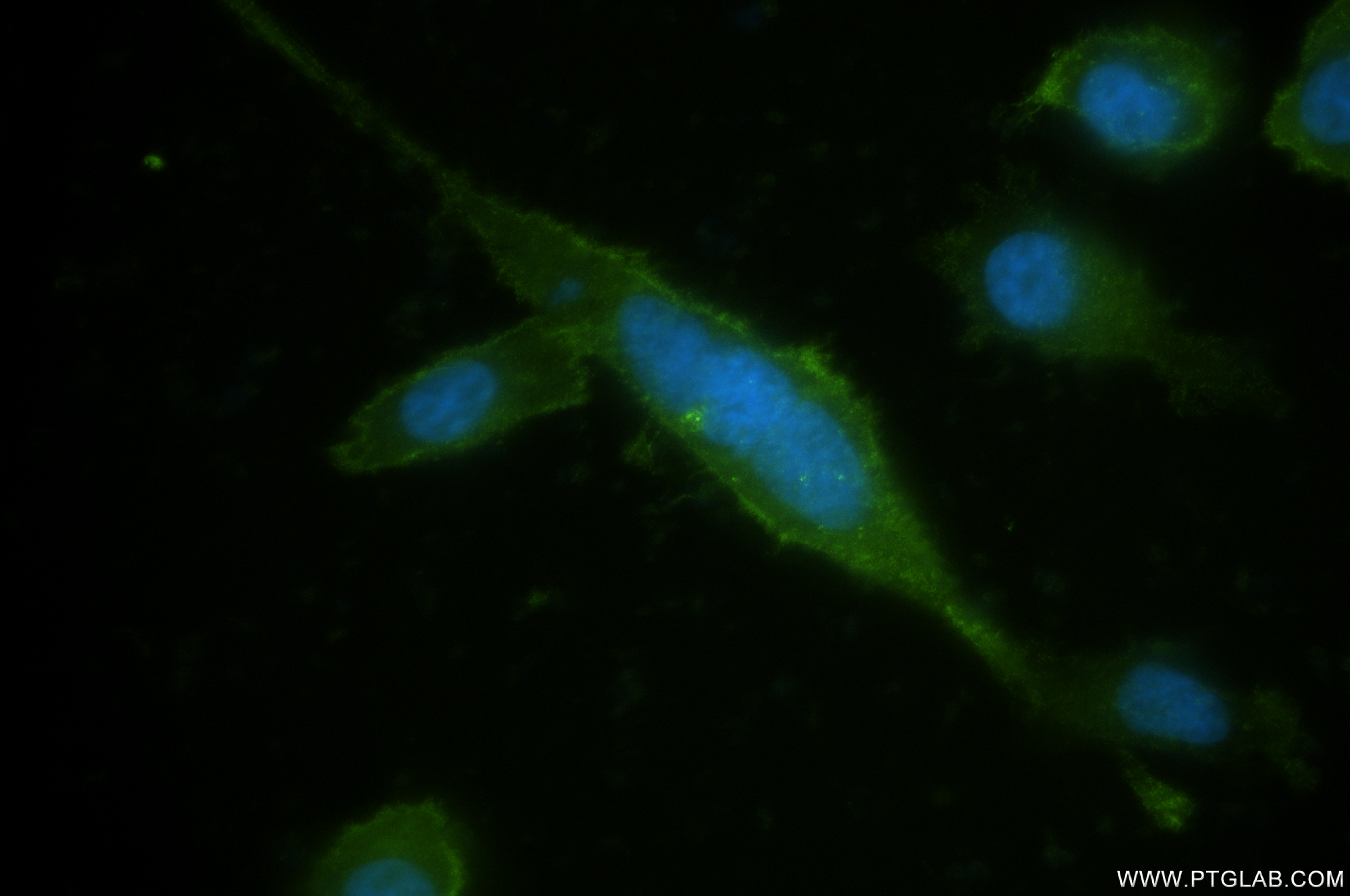 Immunofluorescence (IF) / fluorescent staining of PC-3 cells using DPP4/CD26 Recombinant antibody (84606-6-RR)