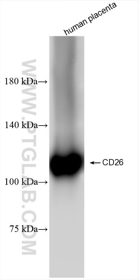 Western Blot (WB) analysis of human placenta tissue using DPP4/CD26 Recombinant antibody (84606-6-RR)