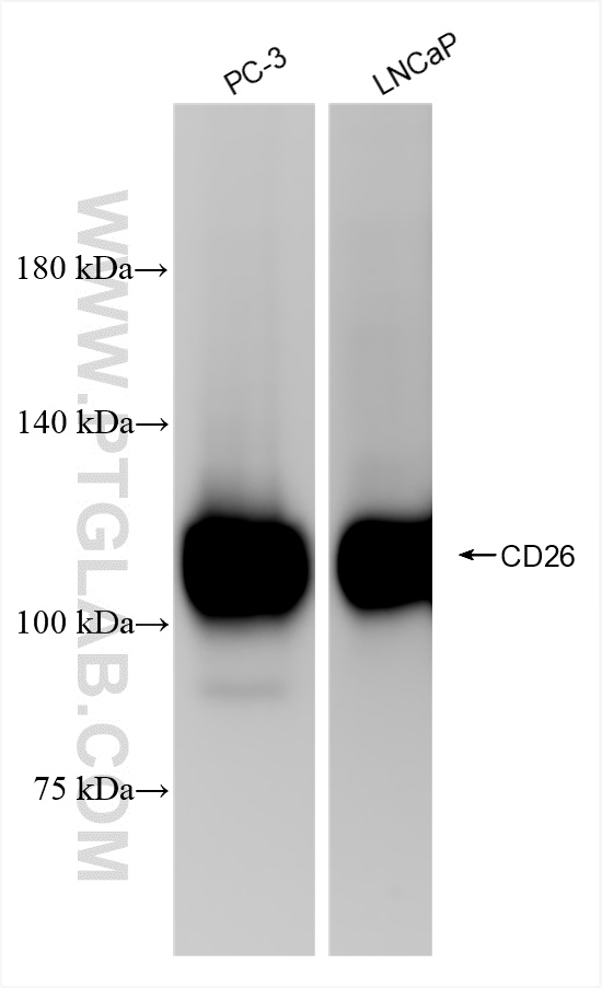 Western Blot (WB) analysis of various lysates using DPP4/CD26 Recombinant antibody (84606-6-RR)