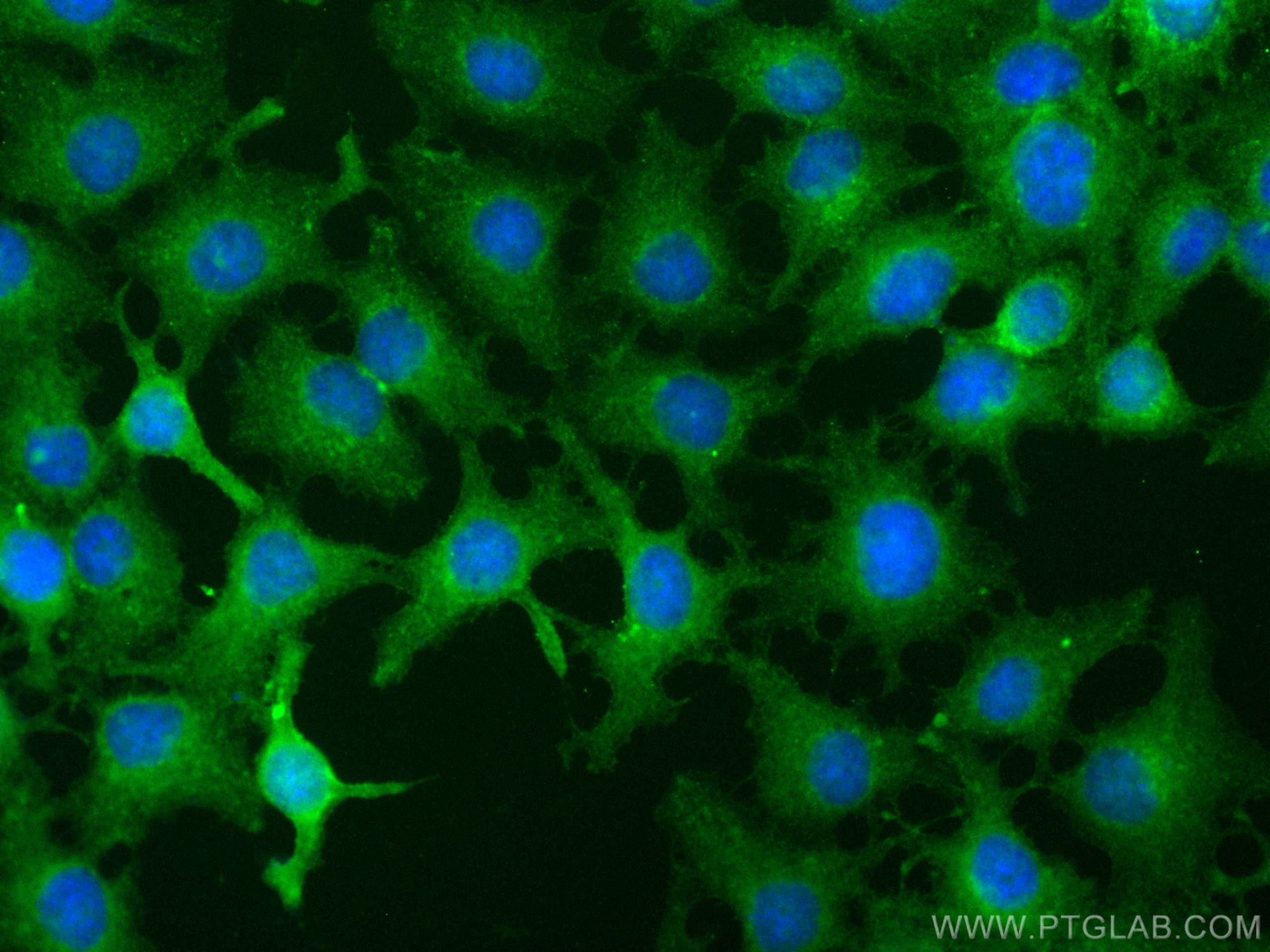 Immunofluorescence (IF) / fluorescent staining of HuH-7 cells using CoraLite® Plus 488-conjugated DPP4/CD26 Monoclonal (CL488-68383)