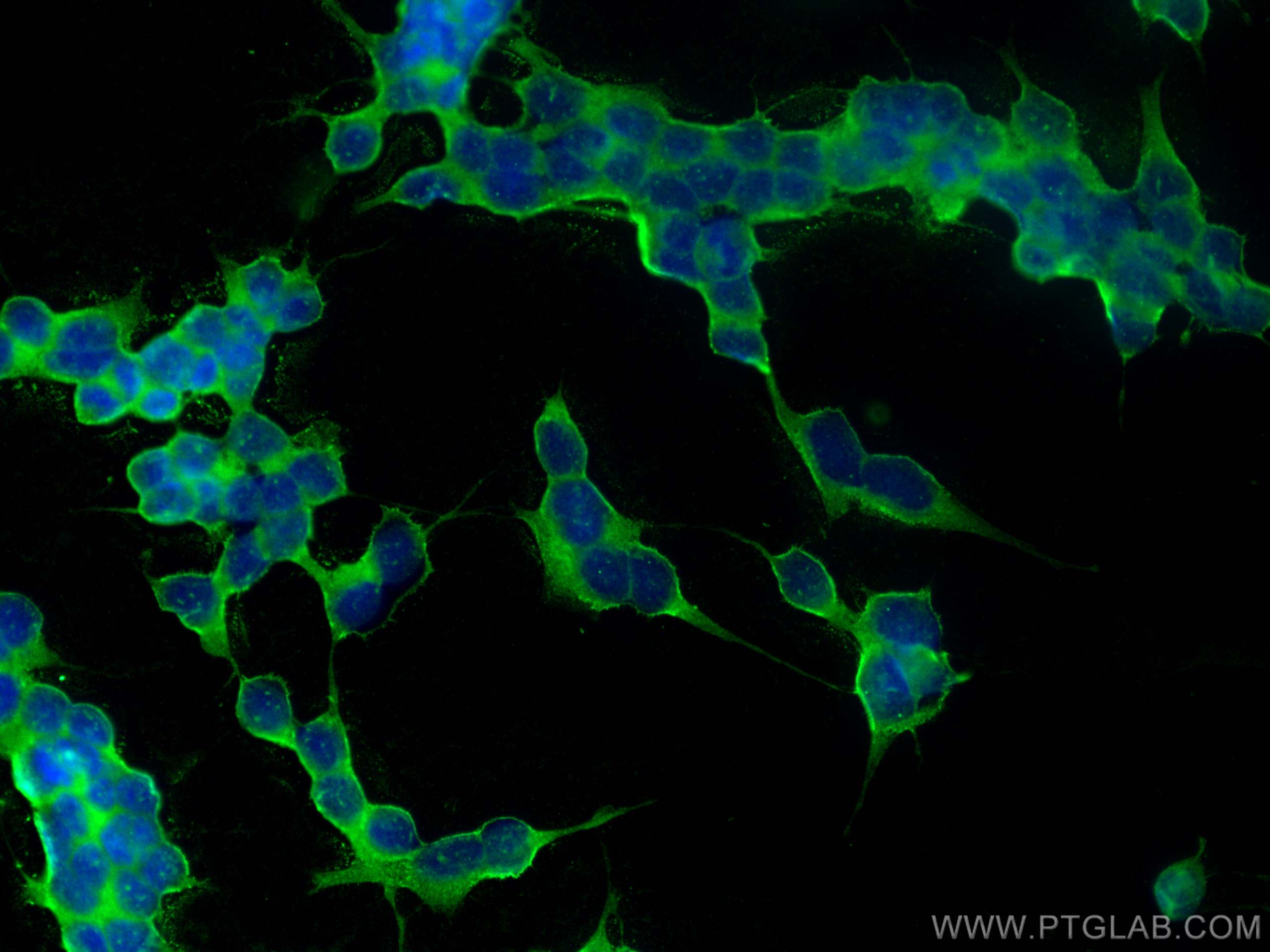 Immunofluorescence (IF) / fluorescent staining of SH-SY5Y cells using DPP6 Polyclonal antibody (28143-1-AP)