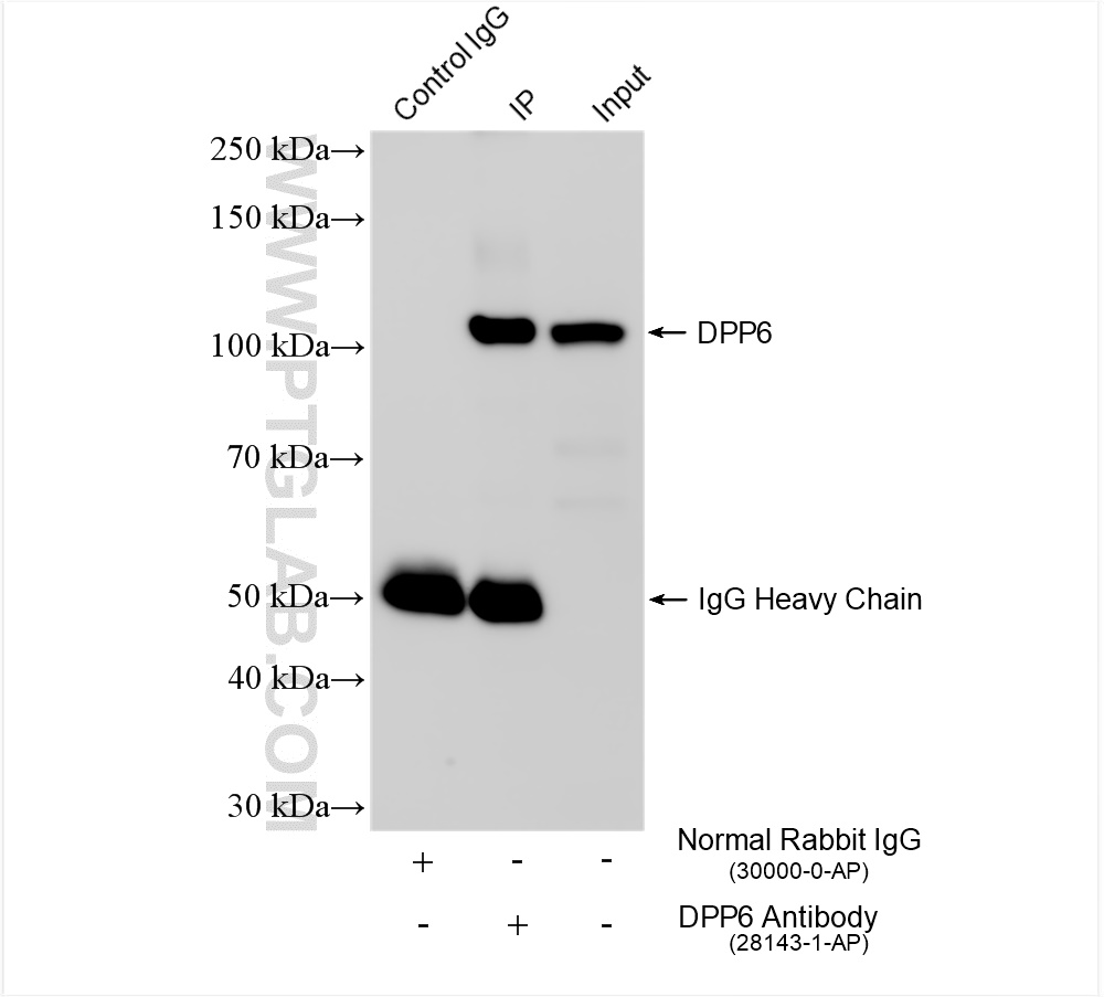 Immunoprecipitation (IP) experiment of mouse brain tissue using DPP6 Polyclonal antibody (28143-1-AP)