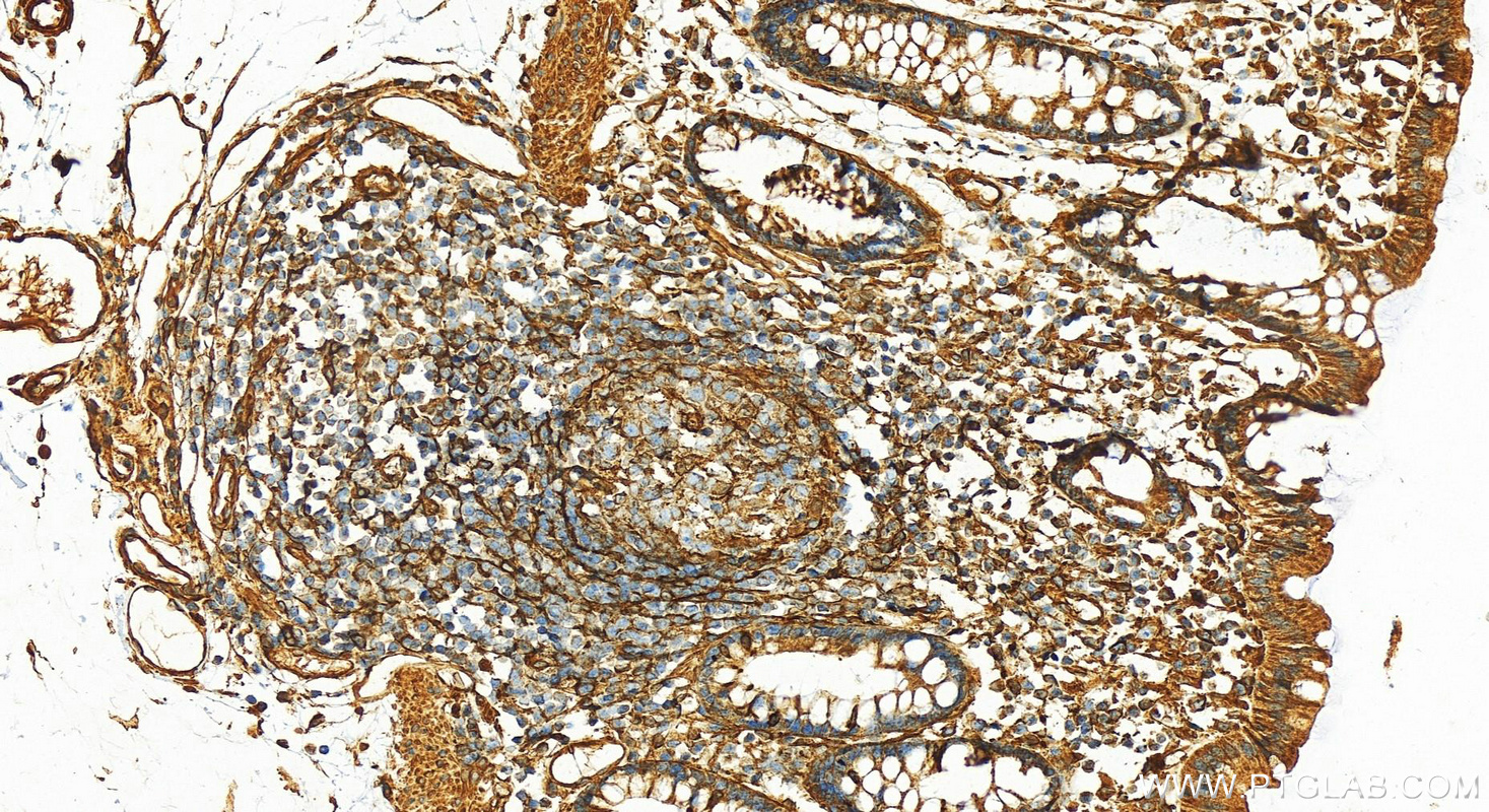 Immunohistochemistry (IHC) staining of human colon tissue using CRMP4 Polyclonal antibody (13661-1-AP)