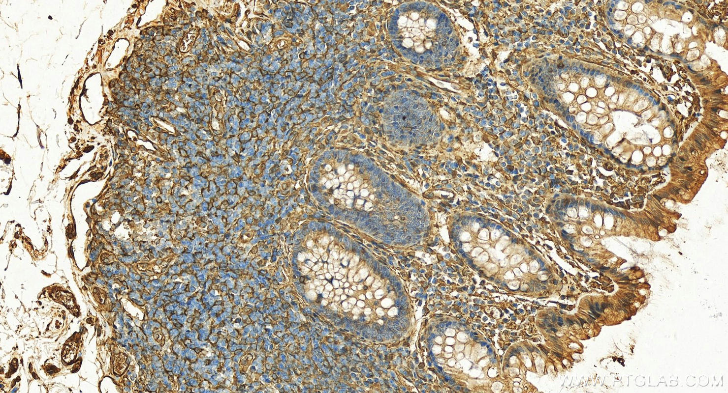 Immunohistochemistry (IHC) staining of human colon tissue using CRMP4 Polyclonal antibody (18969-1-AP)