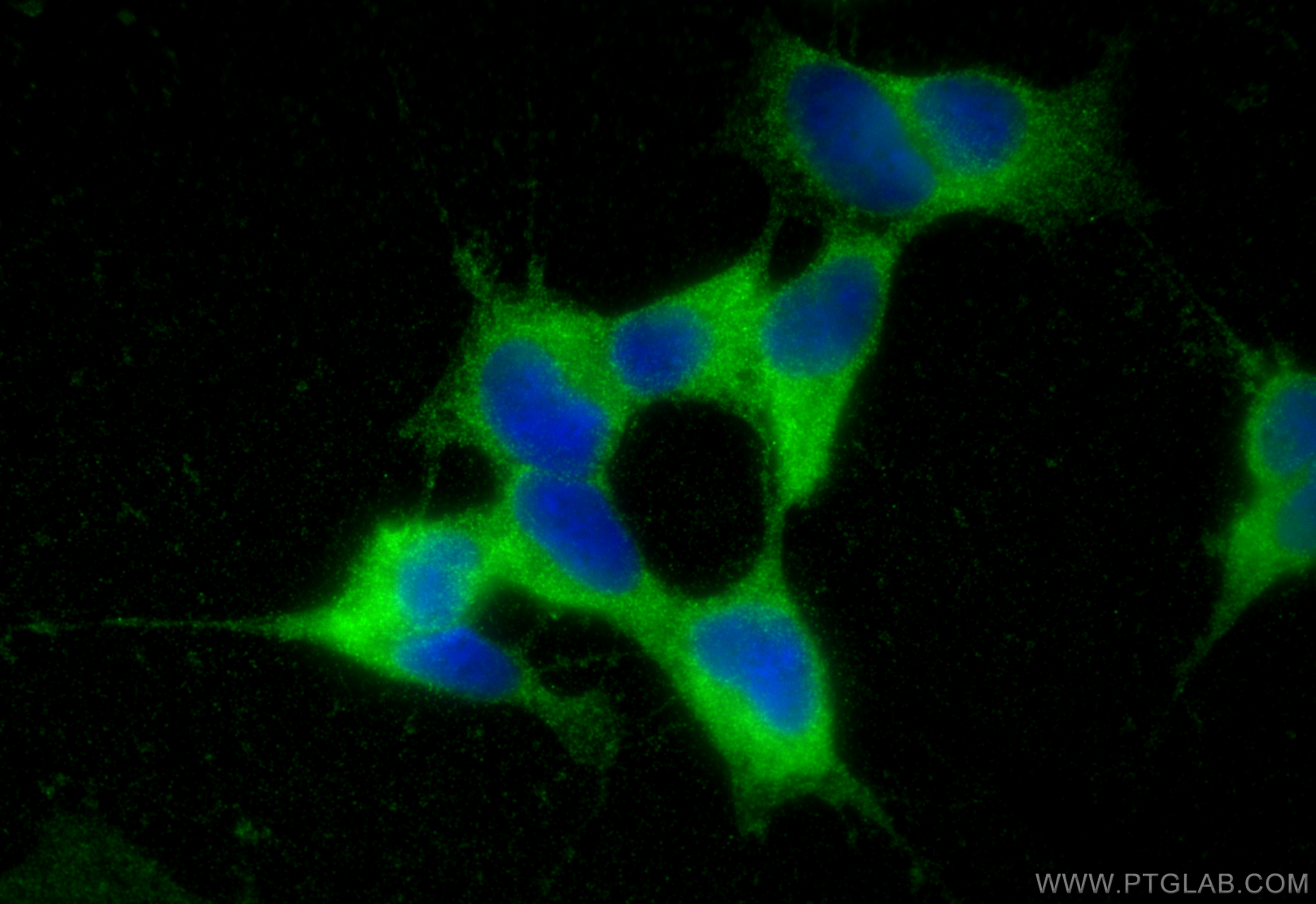 Immunofluorescence (IF) / fluorescent staining of SH-SY5Y cells using CRMP5 Polyclonal antibody (10525-1-AP)