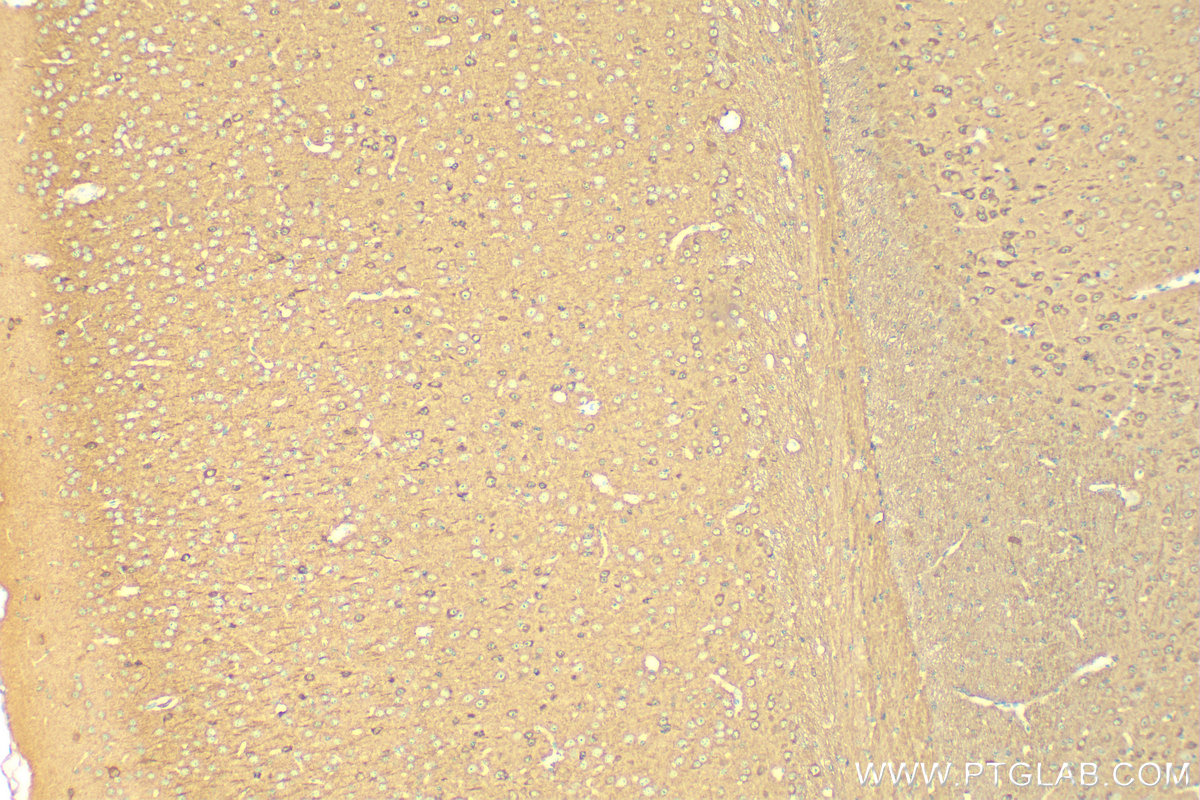 Immunohistochemistry (IHC) staining of mouse brain tissue using CRMP5 Polyclonal antibody (10525-1-AP)