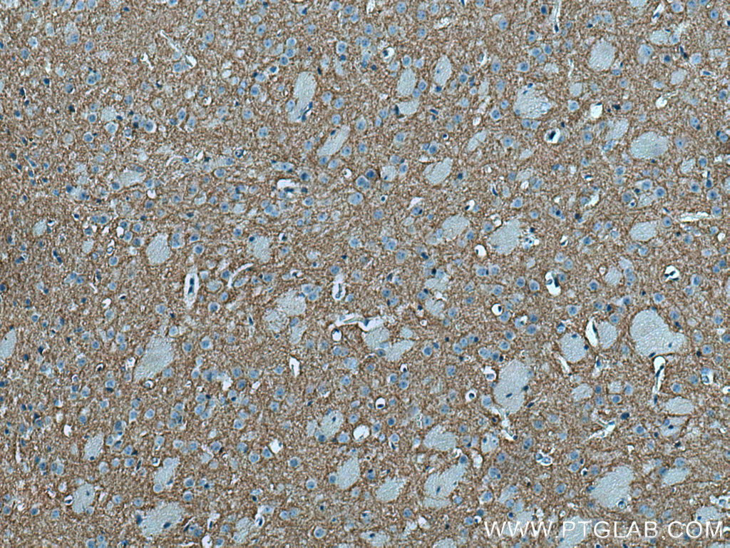 Immunohistochemistry (IHC) staining of mouse brain tissue using DRD1 Polyclonal antibody (17934-1-AP)