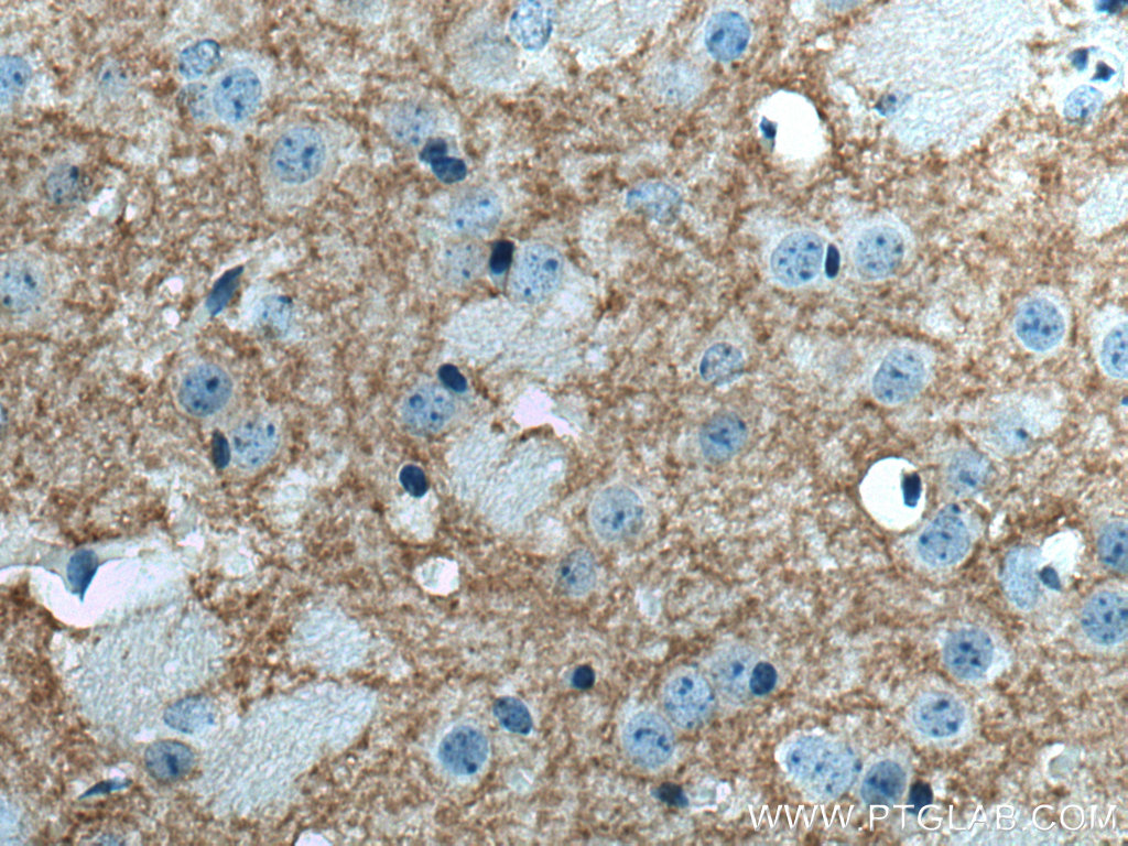 Immunohistochemistry (IHC) staining of mouse brain tissue using DRD1 Polyclonal antibody (17934-1-AP)