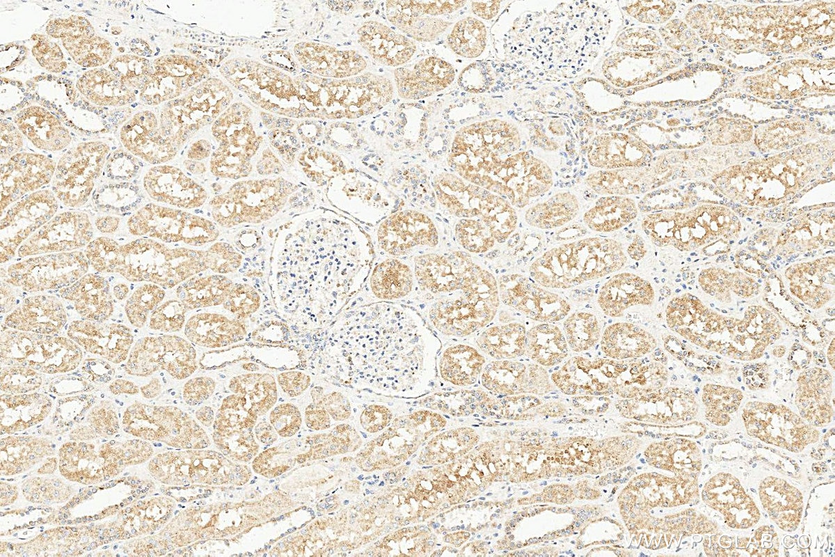 Immunohistochemistry (IHC) staining of human kidney tissue using DRD1 Polyclonal antibody (17934-1-AP)