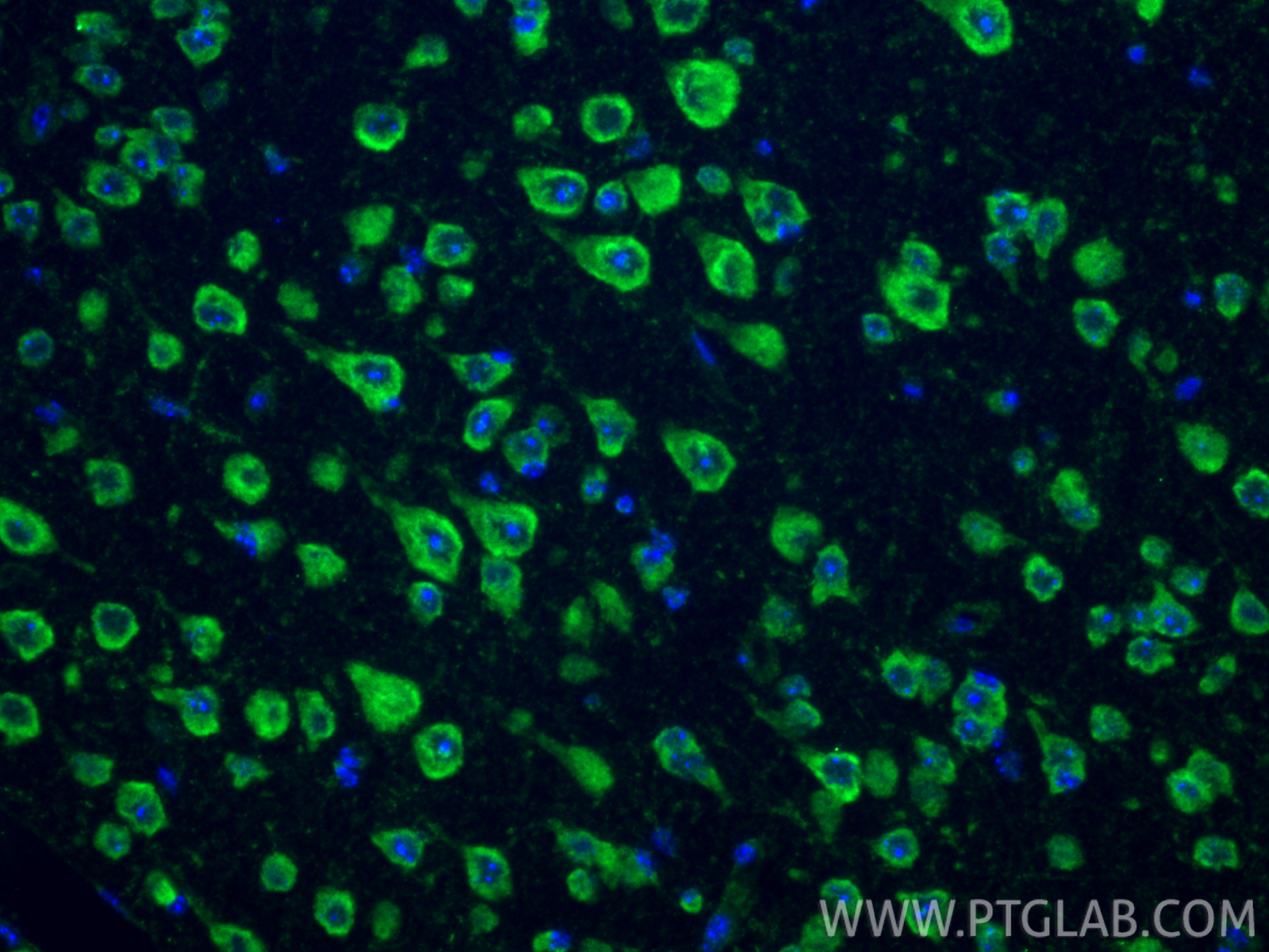Immunofluorescence (IF) / fluorescent staining of mouse brain tissue using DRD2 Polyclonal antibody (55084-1-AP)
