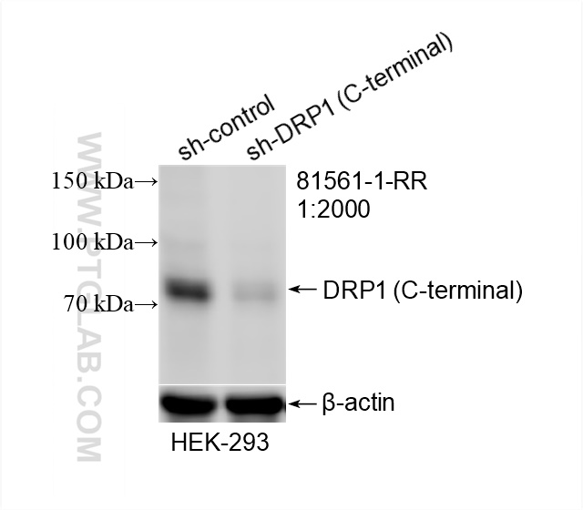 Western Blot (WB) analysis of HEK-293 cells using DRP1 (C-terminal) Recombinant antibody (81561-1-RR)